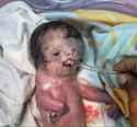 depleted uranium iraq