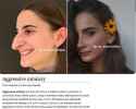 jew before and after