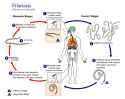 Filariasis_01
