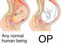 OPinWomb