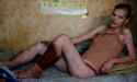 krokodil_effects