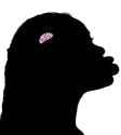 small brain nig