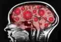 SARS-CoV-2-Brain-1217077007