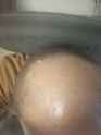 bald head