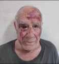 result of the attack on an elderly man by moroccans in the Torre-Pacheco area of Spain