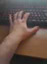 177 KB