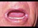 46 KB
