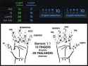 145 KB