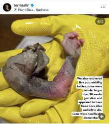 597 KB