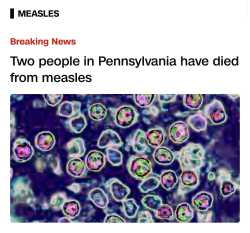 310 KB