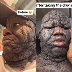 160 KB