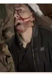 144 KB