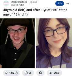 beforeafter