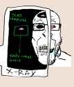 159 KB