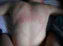 25 KB