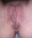 0006557