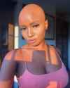 Corporate Barbie® on Instagram_ _It_s Alopecia awareness month-- I announced that I have Alopecia Universalis_ which is the rarest form of Alopecia Areata in 2019 on___CTqR(JPG)