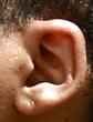 pickle man&#039;s remarkably tiny ear