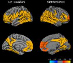 41386_2015_Article_BFnpp201590_Fig2_HTML