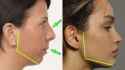 recessed-vs-forward-faces-2010183082