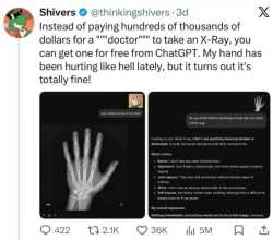 52 KB