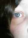 eye