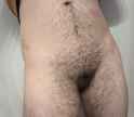 bush