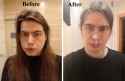 before-after