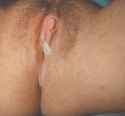 right here