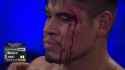 eye cut
