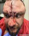 knuck face Mike Richman