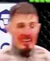 335 KB