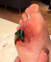 1d4 Piercing damage