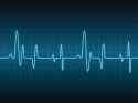 100 KB