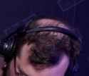 TheBaldening