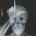 Loser_x-ray