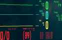 246 KB