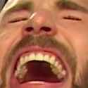 431 KB