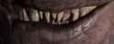 Chompers