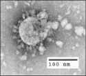 SARS Virus