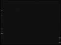 1.25 MB