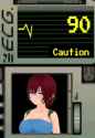 87 KB