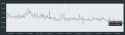 34 KB