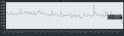 455 KB