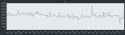 308 KB