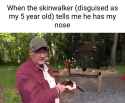 172 KB