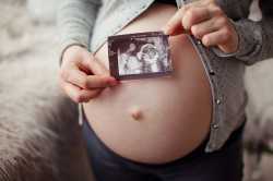 pregnant-woman-with-ultrasound-image-on-belly-a8061b19e2c9446f941ceb1dd253b899