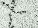laminin