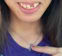 toof